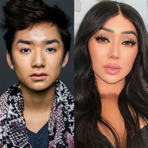 nikita dragun before surgery|Before and After Surgery — An Examination of Nikita。